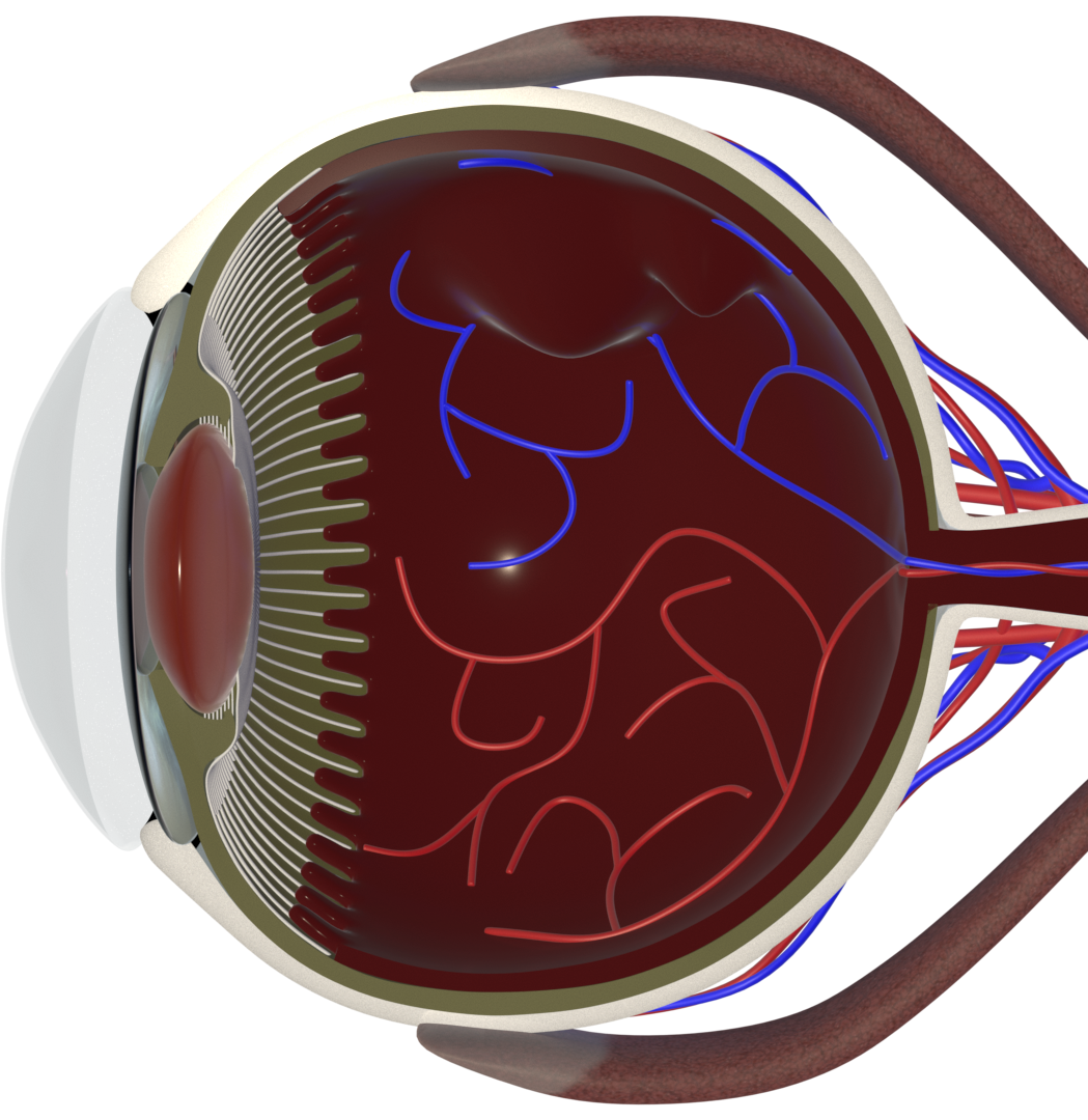 ICL Surgery